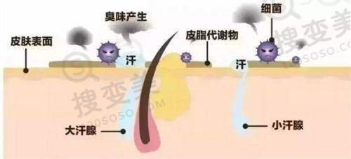 出彩医美十分钟隆胸真的靠谱不是骗局——价格分析