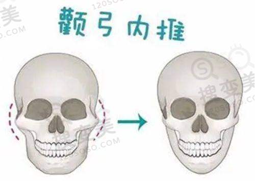 出彩医美十分钟隆胸真的靠谱不是骗局——结论与建议