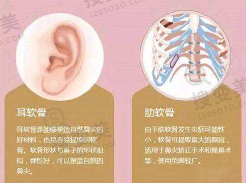 广州广大医院做正颌手术怎样预约?公布广大医院地址/何锦泉医生预约挂号详细方式——何锦泉医生正颌手术预约须知