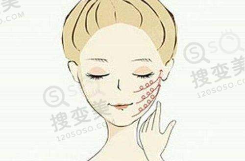上眼睑下垂手术至佳年龄之医院与医生选择