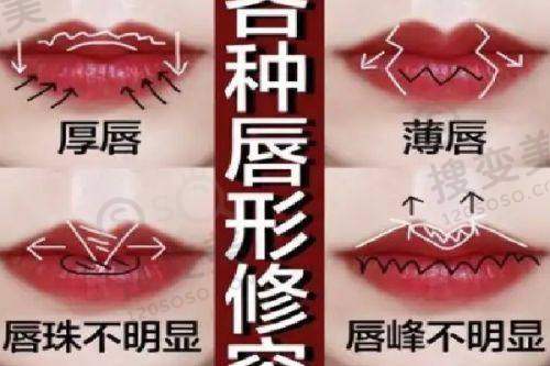 上眼睑下垂手术可以走医疗保险吗之患者类型因素