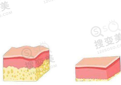 国产三件套使用寿命多久:影响因素分析