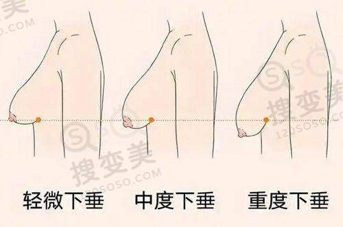 上眼脸下垂是什么原因引起的——药物因素
