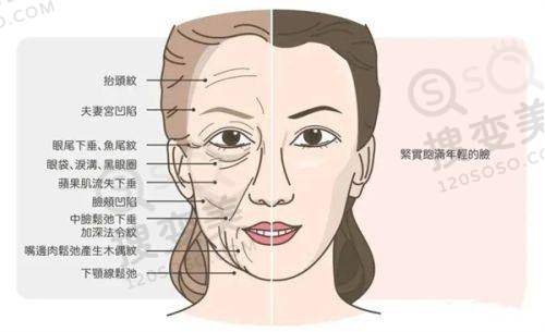 进口三件套假体大概多少钱?——选择手术的注意事项