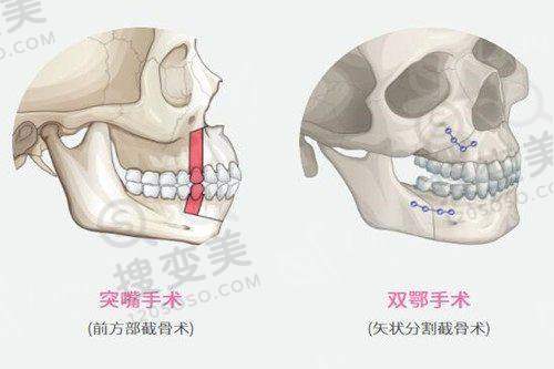 上海更出名的男科医院之就医便利性