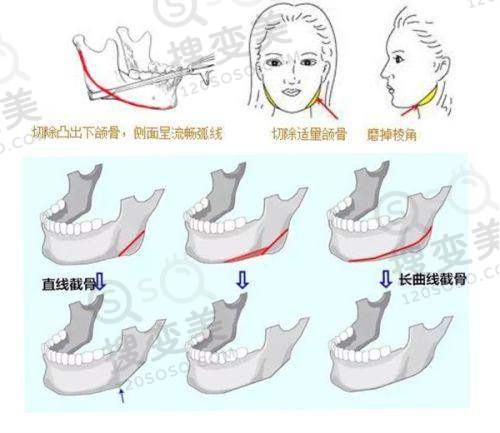 上海更出名的男科医院之收费情况