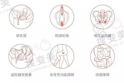 上眼睑下垂手术修复期多久——不同阶段的修复表现及注意事项