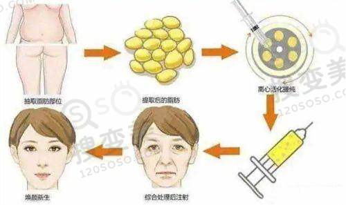 假体三件套10大忠告之品牌选择谨慎