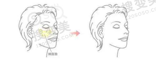 进口三件套使用寿命多久：影响因素分析