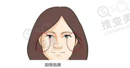 上眼脸下垂是什么原因引起的——额头填充压迫神经和肌肉