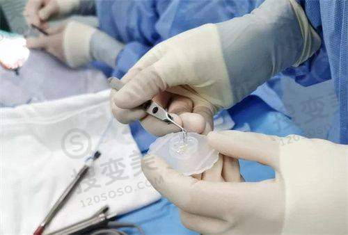 亲历北京茗视光眼科医院全飞秒：周跃华 30 万例经验操刀效果超惊艳！ 