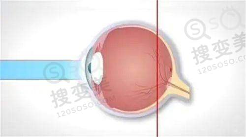 徐州第一人民医院眼科预约挂号攻略:提前1天约，多渠道预约享便捷服务 