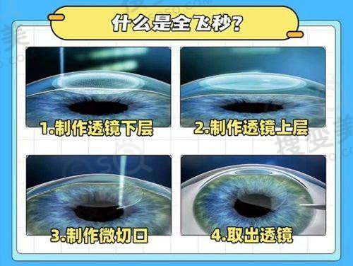 嘉兴爱尔眼科是私立医院吗?是私立医院,但和公办医院一样正规靠谱——服务态度与患者评价