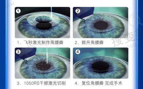 嘉兴爱尔眼科是私立医院吗？是私立医院，但和公办医院一样正规靠谱——医生团队实力