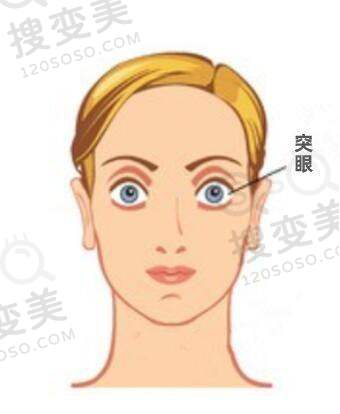 赵培泉眼科预约攻略!加急挂号通道与就诊注意事项全解析!——患者真实反馈参考