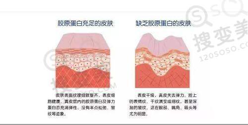北京私密整形去哪家医院好?北京嘉禾私密手术做得不错且价格不贵——北京其他非凡私密整形医院