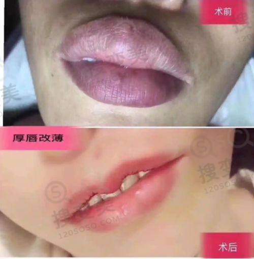 北京私密整形去哪家医院好?北京嘉禾私密手术做得不错且价格不贵——选择私密整形医院的重要性