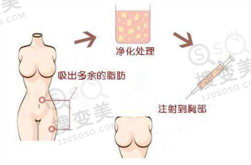 长沙雅美整形田芳斌怎么预约?网上预约灵活多样