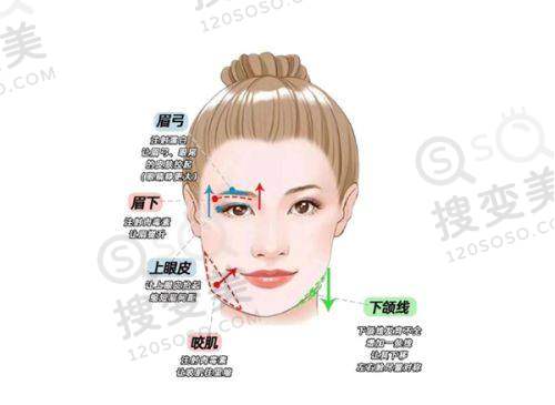 长沙雅美整形田芳斌做双眼皮修复技术怎样?