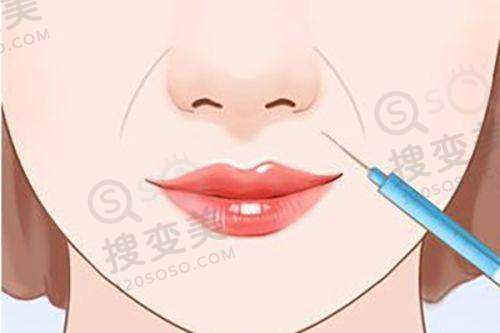 南宁纹眉哪家医院好?华美整形纹眉价格优惠1680元!——消费者选择建议