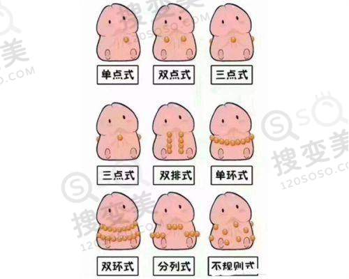 武汉爱尔眼科汉口医院近视手术做的怎么样？技术优口碑好，附近视手术价目表 