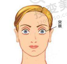 武汉爱尔眼科汉口医院近视手术做的怎么样？患者口碑见证实力