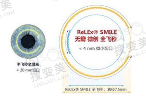 武汉眼科医院项目价格表公开！白内障手术仅需3680元起，全方面解析费用明细！——角膜塑形镜价格情况