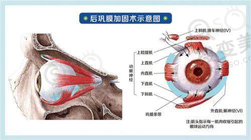 无锡华厦眼科医院地址+联系方式+价格查询:梁溪兴源路可在线电话约，价优口碑好 