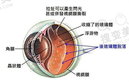 无锡华厦眼科医院价格查询：价优服务满足多样需求