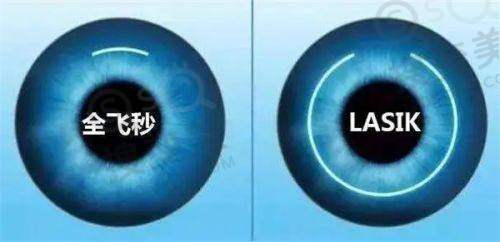 武汉眼科医院项目价格表公开!白内障手术仅需3680元起,全方面解析费用明细!——费用明细解析