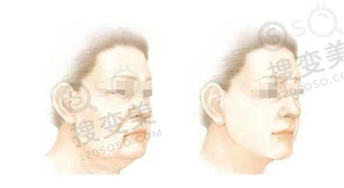 8、衡阳凡美医疗美容门诊部详细的预约挂号方式及流程