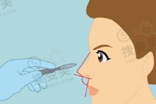 1、衡阳凡美医疗美容门诊部怎么样？