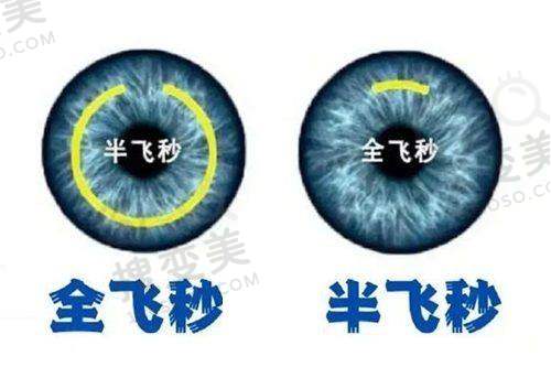 郑州爱尔眼科医院电话是多少?400电话公布!多方式预约挂号超便捷 