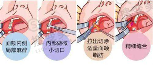 韩国VSLine皮肤科江南店预约攻略手把手教你轻松挂号看诊——术后管理要点