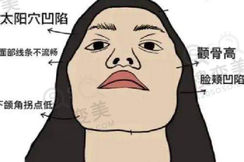 广州华美整形医院好不好？正规吗？郝永生隆胸/无痕双眼皮真人案例揭秘 