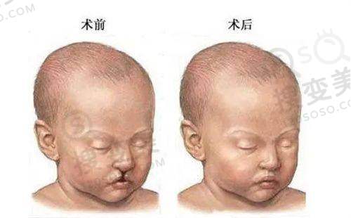 广州有资质的整形医院排名前五名单公布!上榜的都是口碑不错的医院!——广州奥若拉医疗美容门诊部