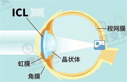 段安丽出诊私立医院有哪几个 - 6个查爱尔/美尔目预约挂号之总结