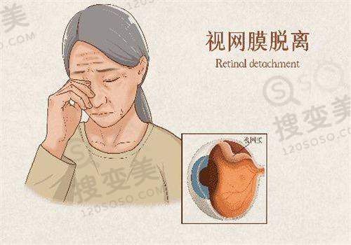 武昌艾格眼科医院口碑怎么样：精良设备提升治疗成效