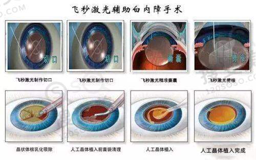 广州荔湾医院取奥美定是真的，去过的人都说齐云香清奥靠谱价格6000元起——医生实力出色