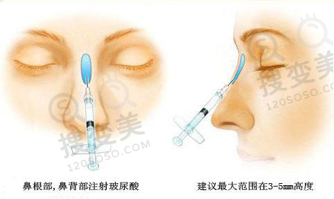 广州华美整形医院好不好?正规吗?真实项目实例公布!——医生团队实力