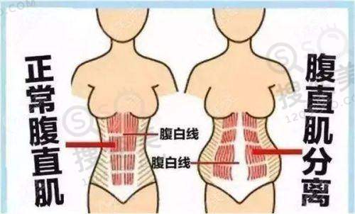 东莞黄金微针多少钱做一次?正规机构收费范围在1500 - 5800左右：机构资质与医生资历的区别
