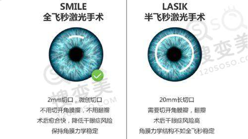 武昌艾格眼科医院手术价格也不贵:性价比高值得选择