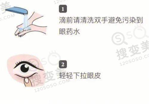 国内做后巩膜加固术好的医生排名，段安丽/齐越/王乐今位列前三——齐越医生介绍