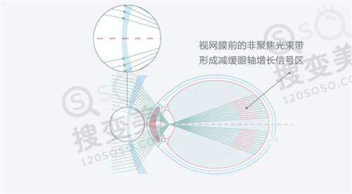 不清楚北京同仁医院哪个区看眼科好?我实地探查了北京同仁眼科东区和西区收费情况区别