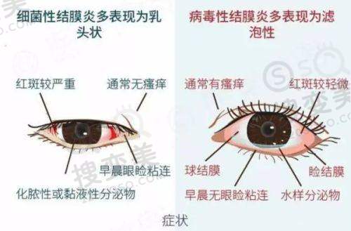 北京眼科具有影响力私立医院排名前三之爱尔英智口碑见证