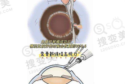武昌艾格眼科医院手术价格也不贵：多样化价格满足不同需求