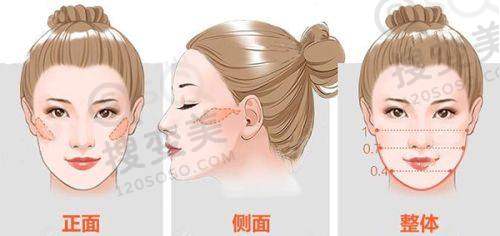 出彩医美十分钟隆胸术后护理怎么做?保护成效特别重要