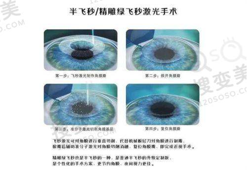 国内哪个医院做后巩膜加固术好?汇总北京同仁等6家医院及齐越等医生优势 