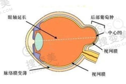 银川西门桥眼科新院地址:搬宁夏眼科对面位置解放西路429号——就诊注意事项