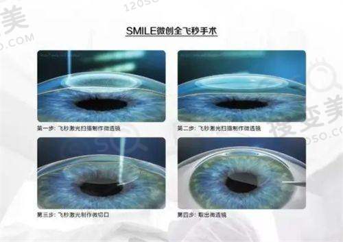 银川西门桥眼科新院地址:搬宁夏眼科对面位置解放西路429号——交通路线指引